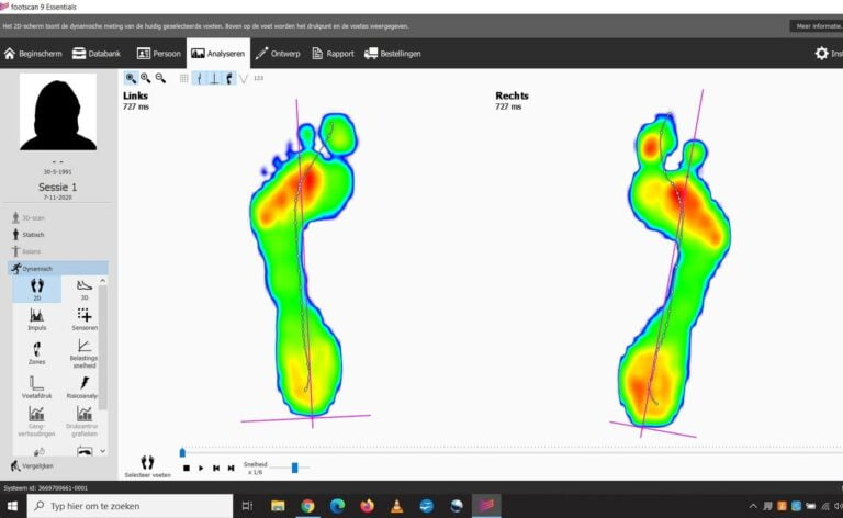 voetdrukscan